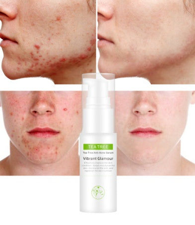 Tea tree acne cream